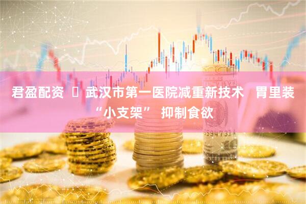 君盈配资  ​武汉市第一医院减重新技术   胃里装“小支架”  抑制食欲